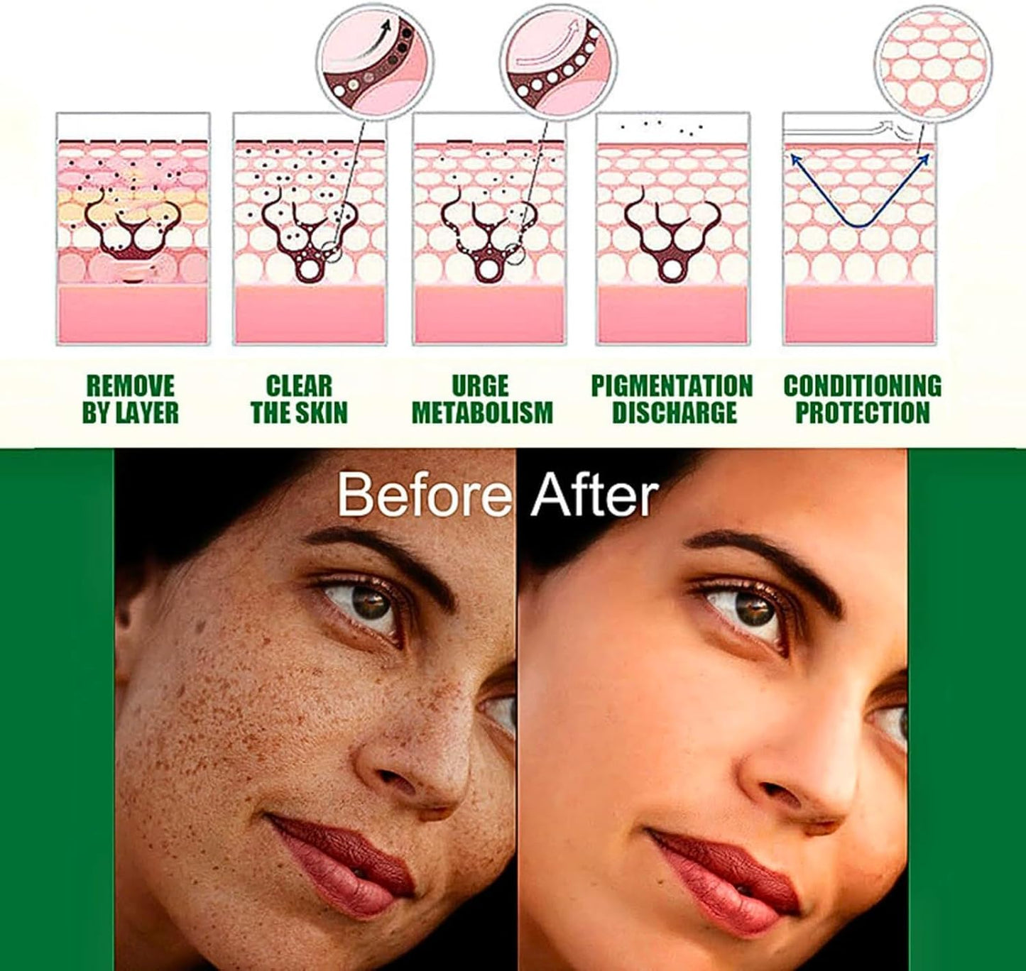 Dark Spot Treatment, Dark Spot Correcting Glow Serum, 5% Niacinamide Serum, Hydrating and Brightening Serum, Anti-Aging, Acne, Fine line, Hyperpigmentation, Tackle Blemishe, Korean Skincare
